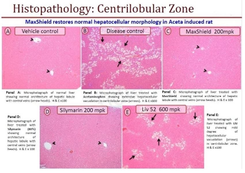 งานวิจัย สารสกัดบำรุงตับ Liver Maxshield
